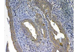 IHC analysis of UGT1A1 using anti-UGT1A1 antibody . (UGT1A1 抗体  (AA 316-533))