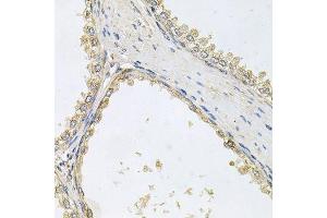 Immunohistochemistry of paraffin-embedded human prostate using POMGNT1 antibody. (POMGNT1 抗体  (AA 411-660))