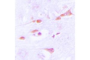 Immunohistochemical analysis of CaMK2 alpha/delta staining in human brain formalin fixed paraffin embedded tissue section. (CaMK2 alpha/delta 抗体  (Center))