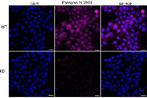 Immunocytochemical staining of HeLa cells using Phospho-NDRG1 (Ser330) antibody (ABIN7799537), 1:1,000), Top panel: wild-type (WT), Bottom panal: Phospho-NDRG1 (Ser330) shRNA knockdown (KD). (Recombinant NDRG1 抗体  (pSer330))