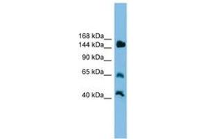 Image no. 1 for anti-Jumonji, AT Rich Interactive Domain 2 (JARID2) (AA 201-250) antibody (ABIN6744599) (JARID2 抗体  (AA 201-250))