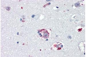 Anti-TAAR8 / TA5 antibody IHC staining of human brain, amygdala. (Trace Amine Associated Receptor 8 (TAAR8) (N-Term) 抗体)
