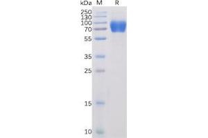 Human SLAMF1 Protein, mFc-His Tag on SDS-PAGE under reducing condition.