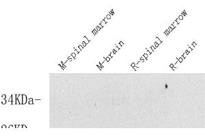 Western Blot analysis of various samples using VIP Polyclonal Antibody at dilution of 1:600. (Vip 抗体)