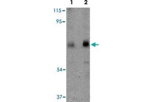 Western blot analysis of CAPN6 in rat lung tissue lysate with CAPN6 polyclonal antibody  at (Lane 1) 0. (Calpain 6 抗体  (C-Term))