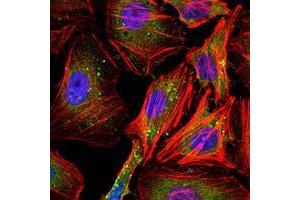 Immunofluorescence analysis of Hela cells using CCNB1 mouse mAb (green). (Cyclin B1 抗体)