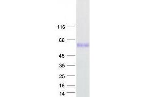 Western Blotting (WB) image for Plasmalemma Vesicle Associated Protein (PLVAP) protein (Myc-DYKDDDDK Tag) (ABIN2729201)