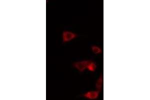 ABIN6275461 staining  HeLa cells by IF/ICC.