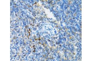 Immunohistochemistry of paraffin-embedded Mouse spleen using UBE2D1 Polyclonal Antibody at dilution of 1:100 (40x lens). (UBE2D1 抗体)