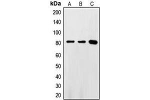 Western blot analysis of FASTKD2 expression in HeLa (A), Jurkat (B), Ramos (C) whole cell lysates. (FASTKD2 抗体  (Center))