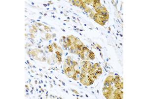 Immunohistochemistry of paraffin-embedded human stomach using CCL8 antibody (ABIN5975074) at dilution of 1/100 (40x lens). (CCL8 抗体)