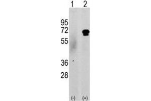 Western blot analysis of CAMKK2 antibody and 293 cell lysate either nontransfected (c) or transiently transfected with the CAMKK2 gene (2). (CAMKK2 抗体  (AA 52-82))