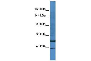 Host:  Rabbit  Target Name:  E2F8  Sample Type:  PANC1 Whole Cell lysates  Antibody Dilution:  1. (E2F8 抗体  (N-Term))