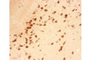 IHC-P testing of rat brain tissue (BDNF 抗体  (AA 129-247))