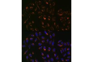 Immunofluorescence analysis of U-2 OS cells using PBR/TSPORabbit mAb (ABIN1679051, ABIN3019258, ABIN3019259 and ABIN7101738) at dilution of 1:100 (40x lens). (TSPO 抗体)