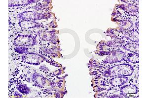 Formalin-fixed and paraffin embedded mouse small intestine tissue labeled with Anti-CCL24 Polyclonal Antibody, Unconjugated (ABIN740925) at 1:200 followed by conjugation to the secondary antibody and DAB staining (CCL24 抗体  (AA 27-119))