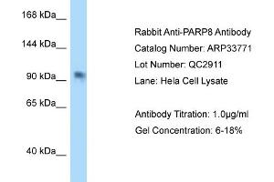 WB Suggested Anti-PAntibody   Titration: 1. (PARP8 抗体  (C-Term))