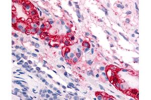 Immunohistochemistry (IHC) image for anti-Corticotropin Releasing Hormone Receptor 1 (CRHR1) (N-Term) antibody (ABIN213513)