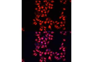 Immunofluorescence analysis of HeLa cells using  antibody (ABIN6129173, ABIN6136519, ABIN6136520 and ABIN6214691) at dilution of 1:100. (ADAM10 抗体  (AA 214-500))