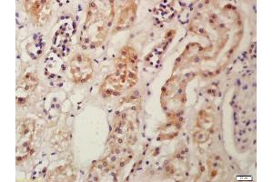 Formalin-fixed and paraffin embedded human kidney labeled with Anti-Frizzled 9/CD349 Polyclonal Antibody, Unconjugated (ABIN1386280) at 1:200 followed by conjugation to the secondary antibody and DAB staining (FZD9 抗体  (AA 185-270))