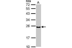 WB Image Sample (30 ug of whole cell lysate) A: NT2D1 12% SDS PAGE antibody diluted at 1:1000 (Ube2t 抗体  (C-Term))