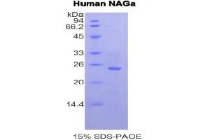 SDS-PAGE analysis of Human NAGa Protein.