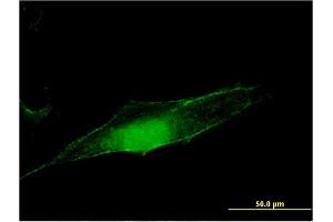 Immunofluorescence of monoclonal antibody to MGEA5 on HeLa cell. (MGEA5 抗体  (AA 823-916))