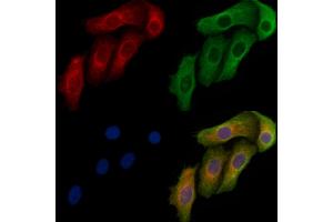 ABIN6264324 and ABIN6272396 staining Hela cells by IF/ICC.