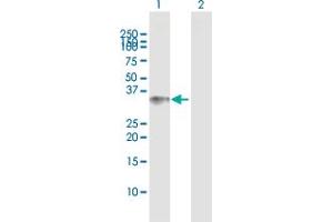 Western Blot analysis of BCL11A expression in transfected 293T cell line by BCL11A MaxPab polyclonal antibody. (BCL11A 抗体  (AA 1-243))