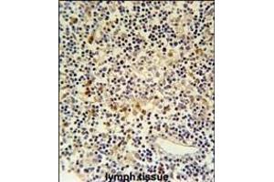 CORO6 Antibody (Center) (ABIN651025 and ABIN2840041) immunohistochemistry analysis in formalin fixed and paraffin embedded human lymph tissue followed by peroxidase conjugation of the secondary antibody and DAB staining. (Coronin 6 抗体  (AA 196-224))