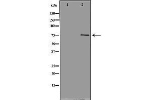 Western blot analysis of Hela whole cell lysates, using NEK8 Antibody. (NEK8 抗体  (Internal Region))