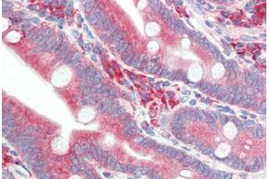 Human Small Intestine (formalin-fixed, paraffin-embedded) stained with HYOU1 antibody ABIN396969 at 5 ug/ml followed by biotinylated goat anti-rabbit IgG secondary antibody ABIN481713, alkaline phosphatase-streptavidin and chromogen. (HYOU1 抗体  (C-Term))