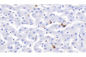 Immunohistochemistry (IHC) image for anti-S100 Calcium Binding Protein A12 (S100A12) (AA 2-92) antibody (ABIN7444682)