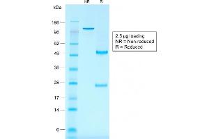 SDS-PAGE Analysis Purified CD30 Mouse Recombinant Monoclonal Antibody (rKi-1/779).