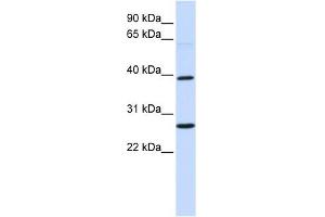 WNT16 antibody used at 1 ug/ml to detect target protein. (WNT16 抗体  (Middle Region))