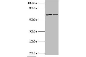 Western blot All lanes: Myotubularin antibody at 2 μg/mL Lane 1: Jurkat whole cell lysate Lane 2: HepG2 whole cell lysate Secondary Goat polyclonal to rabbit IgG at 1/10000 dilution Predicted band size: 70, 67 kDa Observed band size: 70 kDa (MTM1 抗体  (AA 484-603))