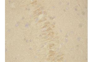 Immunohistochemistry (Formalin/PFA-fixed paraffin-embedded sections) of rat brain tissue with PSEN2 polyclonal antibody . (Presenilin 2 抗体  (Internal Region))