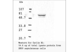 Image no. 3 for anti-Cyclin B1 (CCNB1) antibody (ABIN599627) (Cyclin B1 抗体)
