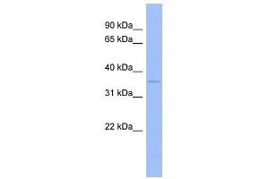 WNT5B antibody used at 1 ug/ml to detect target protein.