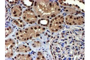 Immunohistochemical staining of paraffin-embedded Human Kidney tissue using anti-TOMM34 mouse monoclonal antibody. (TOMM34 抗体)