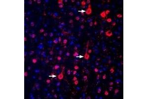 Expression of GPR17 in rat parietal cortex - Immunohistochemical staining of perfusion-fixed frozen rat brain sections with Anti-GPR17 Antibody (ABIN7043149, ABIN7044435 and ABIN7044436), (1:300), followed by donkey-anti-rabbit-biotin and streptavidin-Cy3. (GPR17 抗体  (Intracellular))