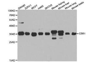 Western blot analysis of extracts of various cell lines, using CBR1 antibody. (CBR1 抗体  (AA 1-277))