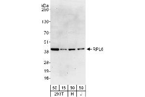 anti-Ribosomal Protein L6 (RPL6) (AA 125-175) antibody
