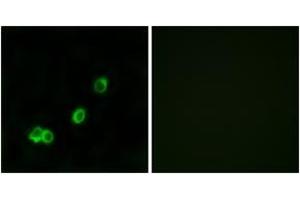 Immunofluorescence analysis of MCF7 cells, using ACOT1 Antibody. (ACOT1 抗体  (AA 91-140))