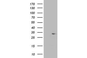 Image no. 1 for anti-Short Chain Dehydrogenase/reductase Family 9C, Member 7 (SDR9C7) (AA 1-313) antibody (ABIN1490738) (SDR9C7 抗体  (AA 1-313))