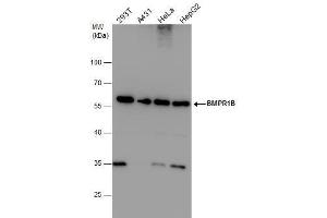 WB Image BMPR1B antibody detects BMPR1B protein by western blot analysis. (BMPR1B 抗体)