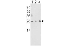 Western Blotting (WB) image for anti-Triosephosphate Isomerase 1 (TPI1) antibody (ABIN3001712) (TPI1 抗体)