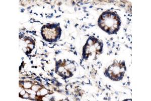 IHC analysis of VPRBP/DCAF1 using anti-VPRBP/DCAF1 antibody (ABIN7602005). (DDB1 and CUL4-Associated Factor 1 (DCAF1) (AA 540-861) 抗体)