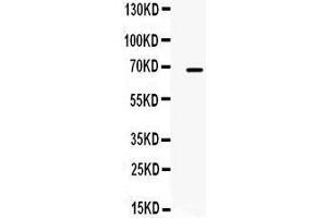 Western Blotting (WB) image for anti-Matrix Metallopeptidase 9 (Gelatinase B, 92kDa Gelatinase, 92kDa Type IV Collagenase) (MMP9) (AA 633-667), (C-Term) antibody (ABIN3043582) (MMP 9 抗体  (C-Term))