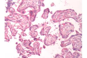 Human Placenta: Formalin-Fixed, Paraffin-Embedded (FFPE) (BDKRB1 抗体  (C-Term))